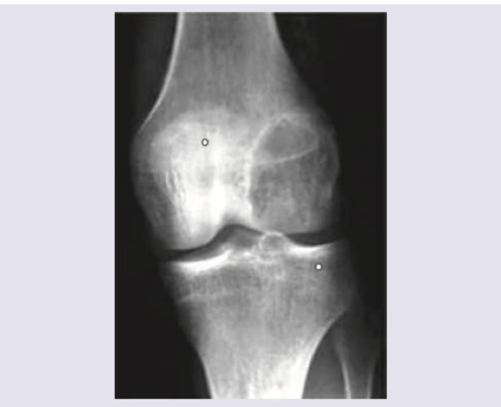 Image for question 252