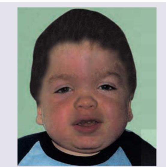 Image for question 642