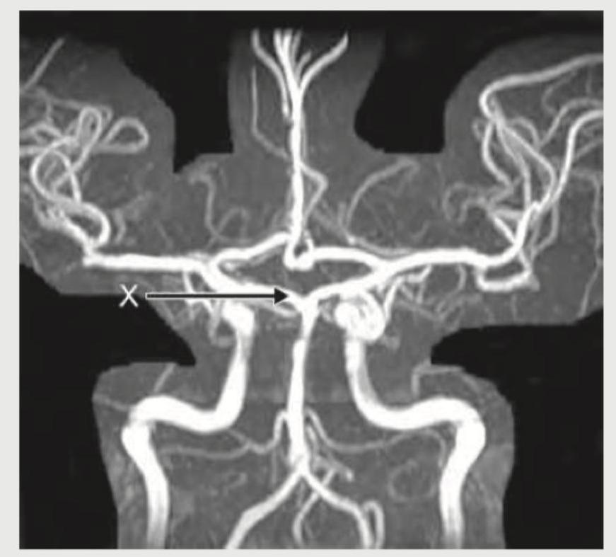 Image for question 372