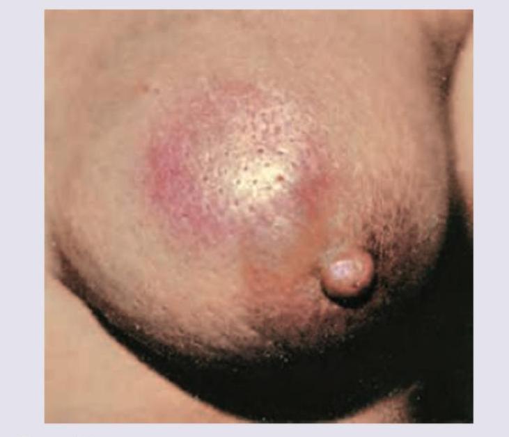 Image for question 700