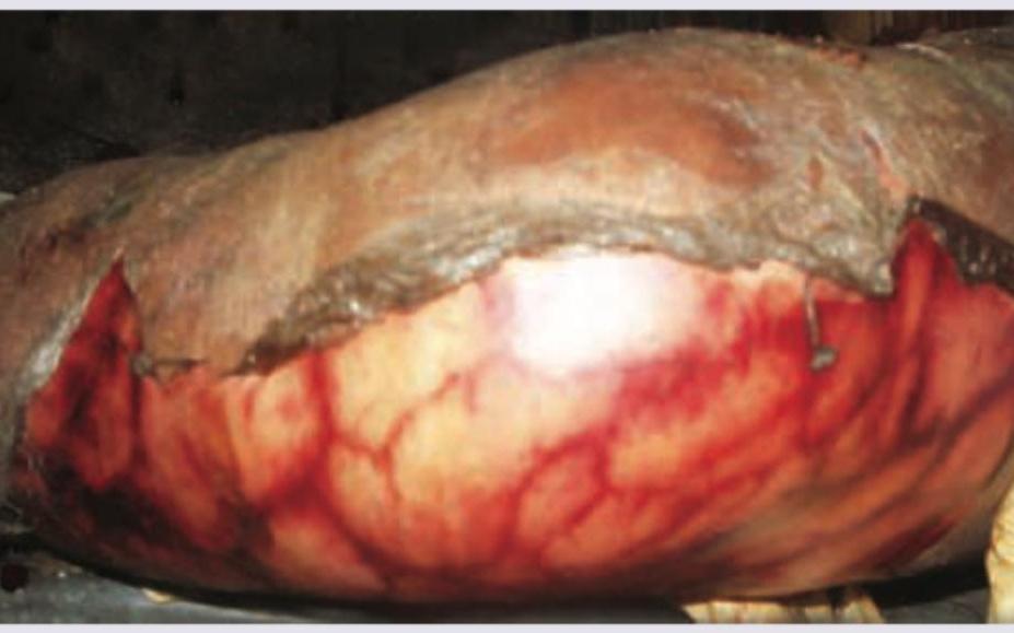 Image for question 235