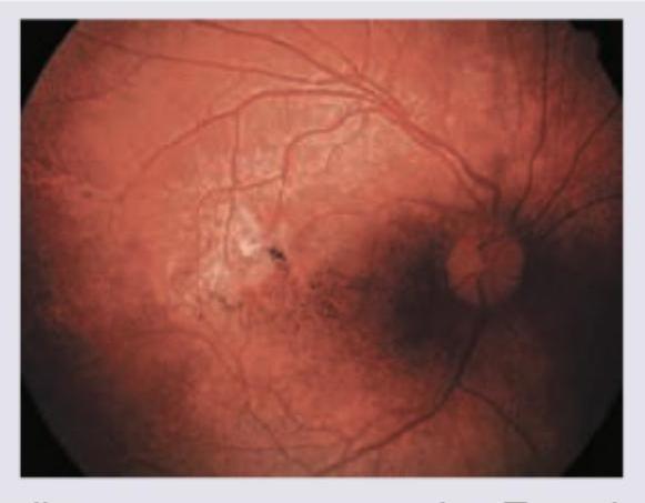 Image for question 451