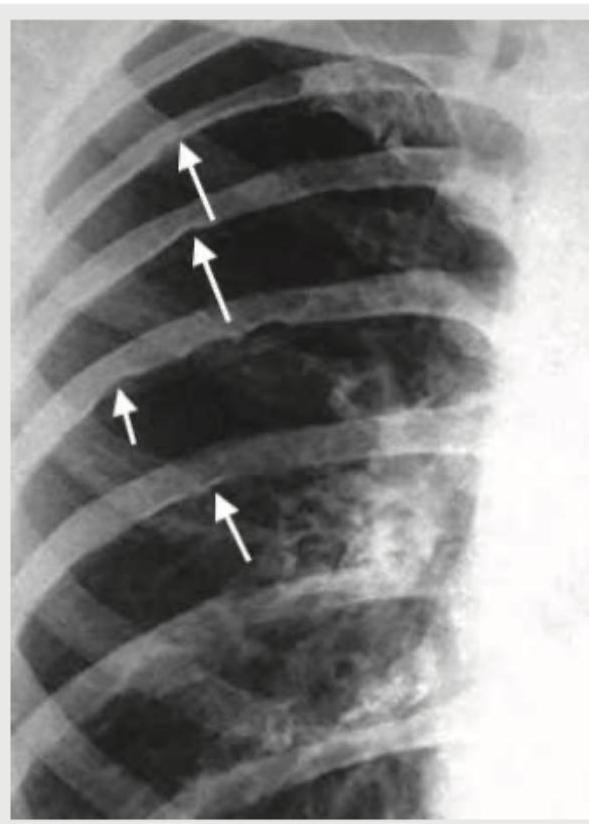 Image for question 101