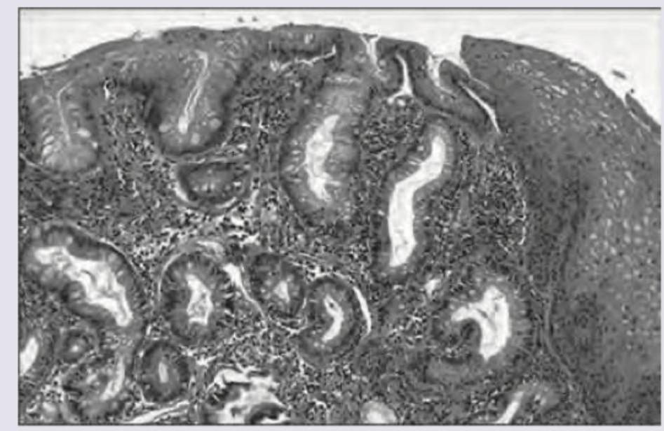 Image for question 462