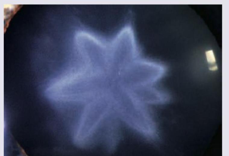 Image for question 243