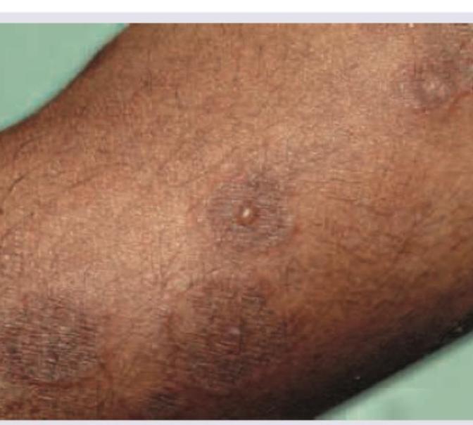 Image for question 72