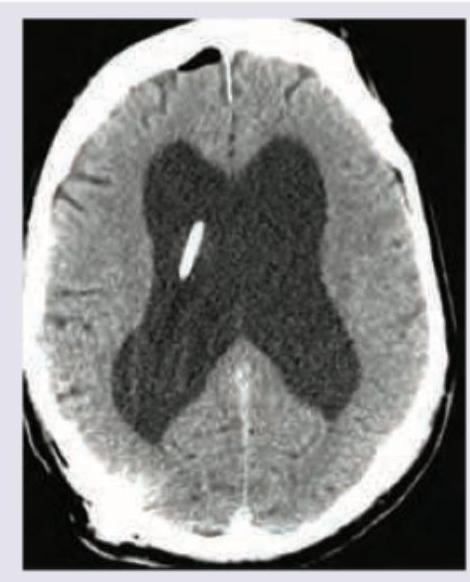 Image for question 751