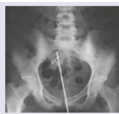 Image for question 557