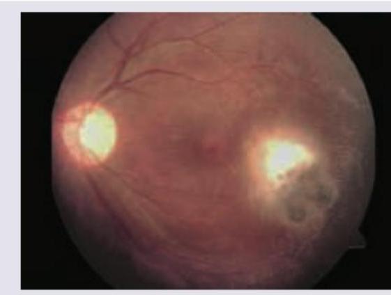 Image for question 447