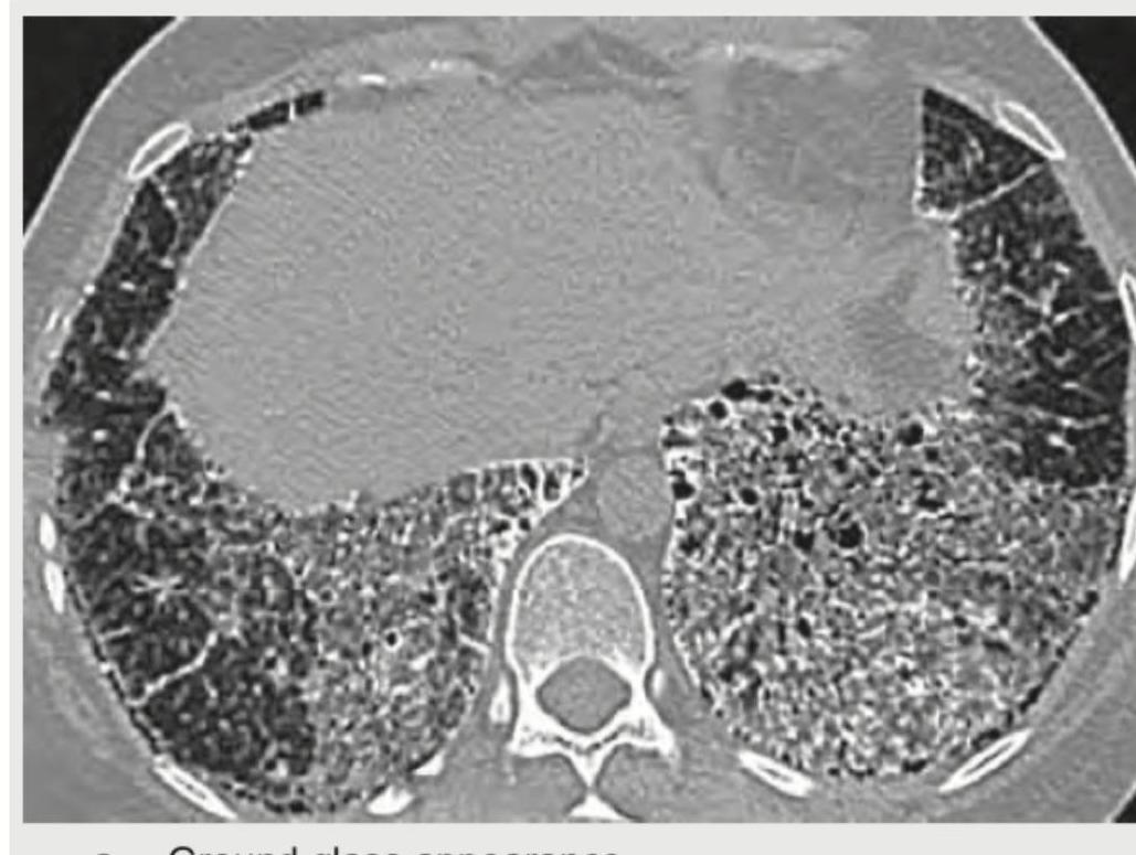 Image for question 395