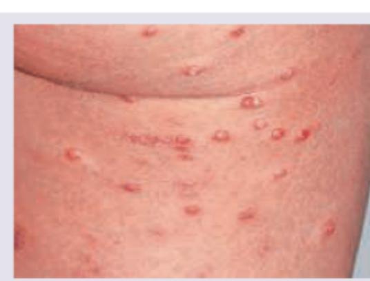 Image for question 164