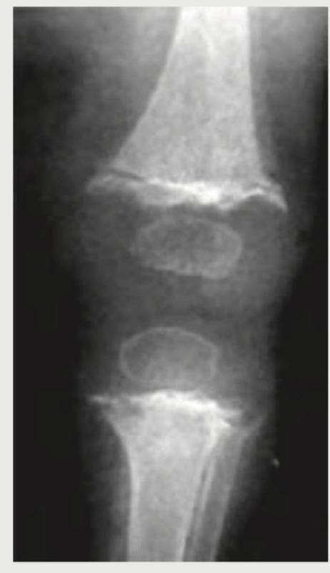 Image for question 142