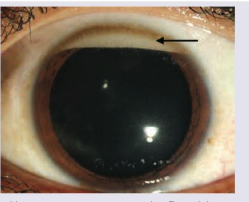 Image for question 92