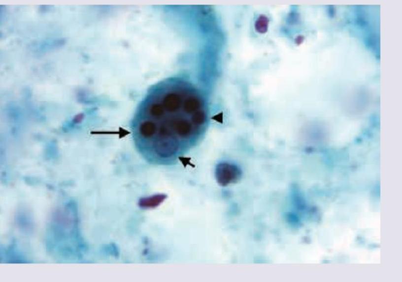 Image for question 782