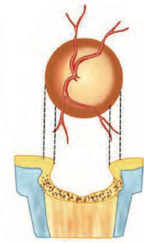 Image for question 318