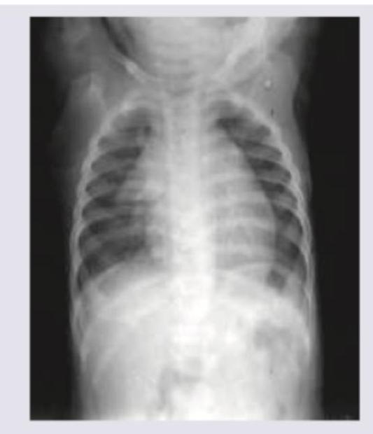 Image for question 56