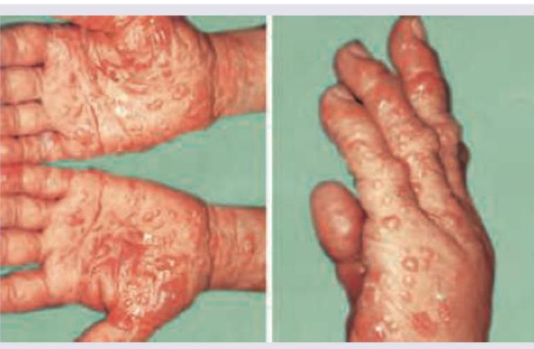 Image for question 70