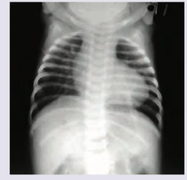 Image for question 93