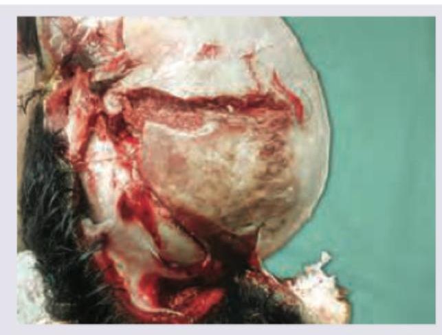 Image for question 496