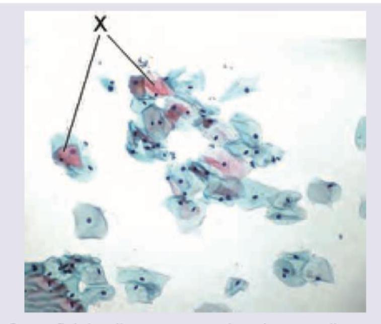 Image for question 9