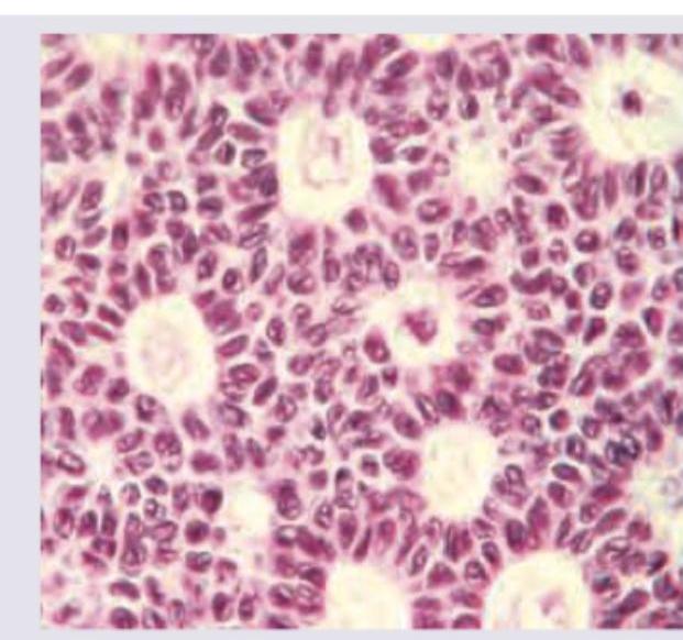 Image for question 237