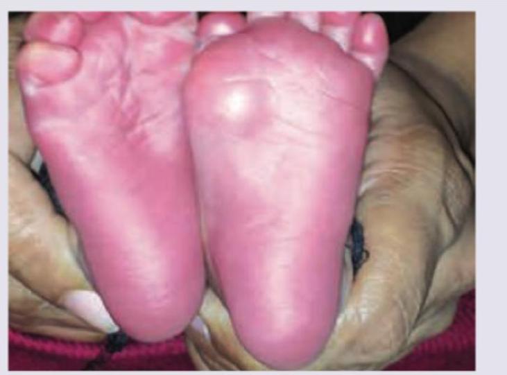 Image for question 55