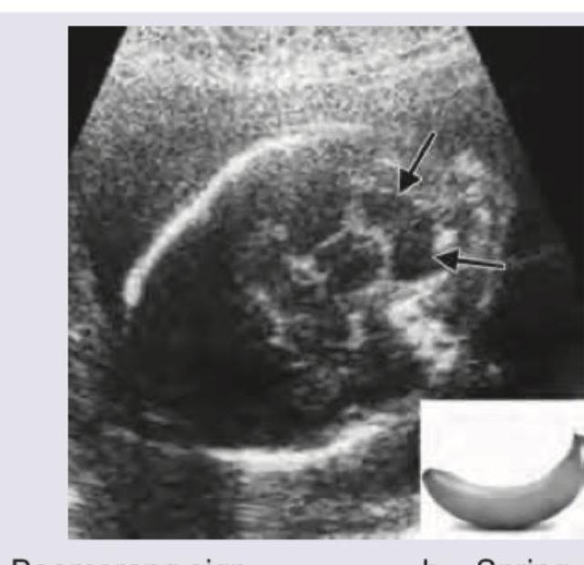 Image for question 947