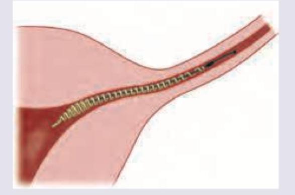 Image for question 561