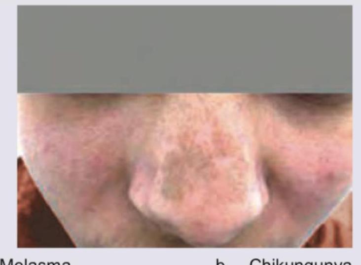 Image for question 3