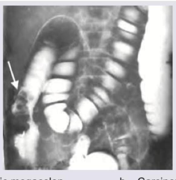 Image for question 167