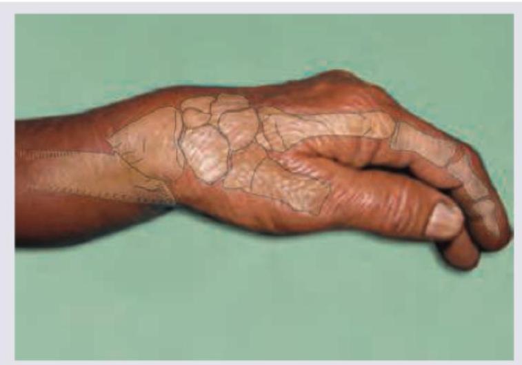 Image for question 916