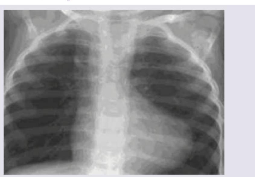 Image for question 62