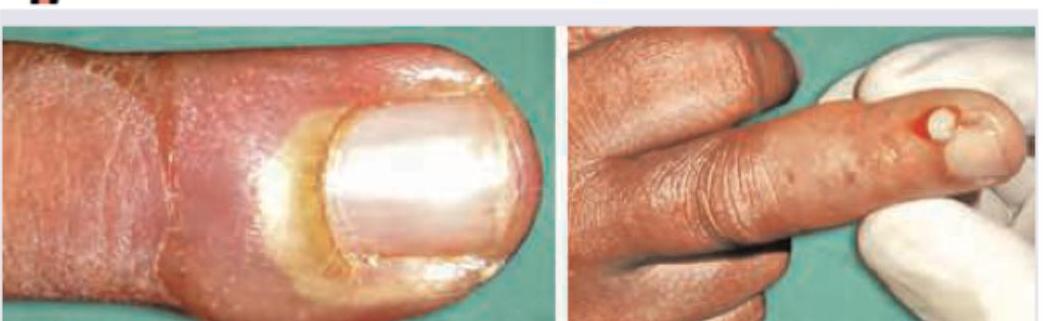 Image for question 102