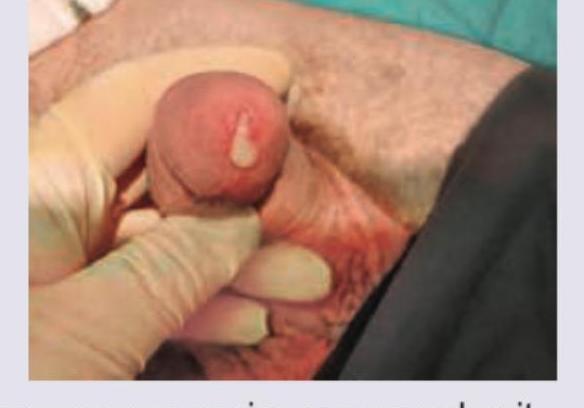 Image for question 77