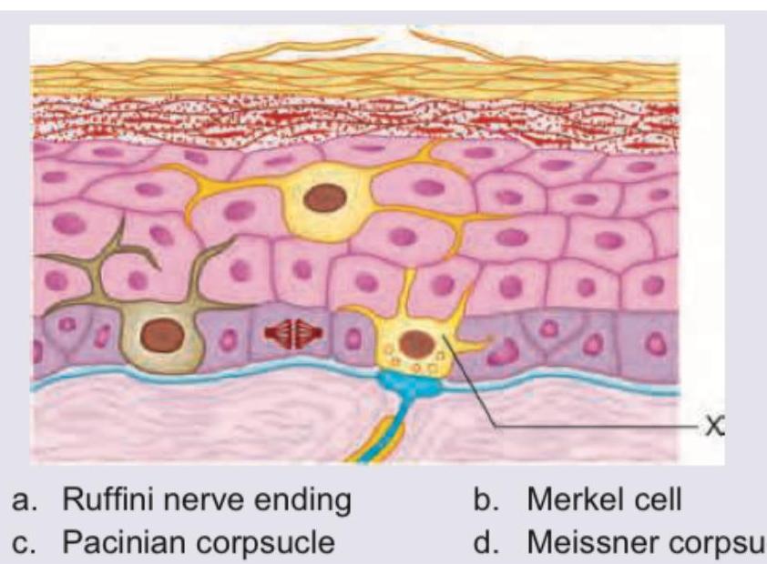Image for question 381