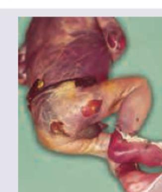 Image for question 167