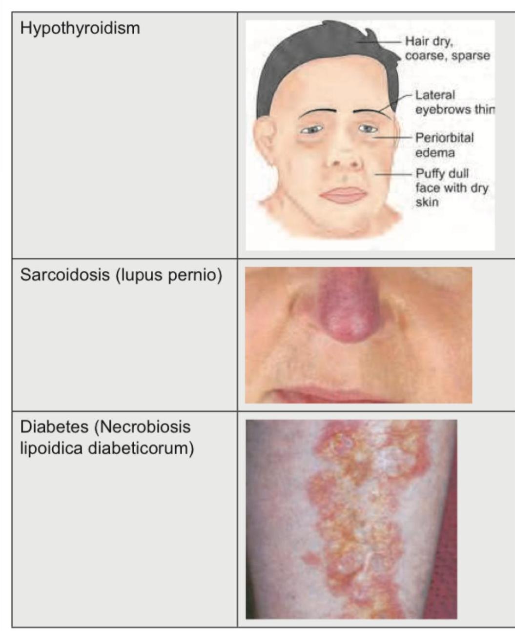 Image for question 795