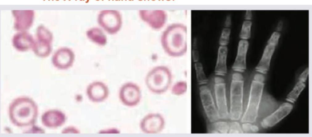 Image for question 74