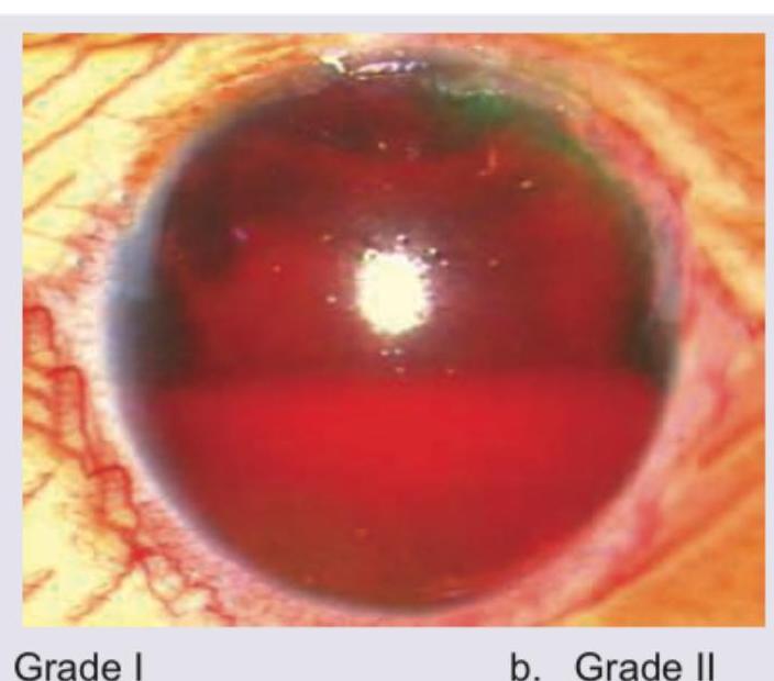 Image for question 895