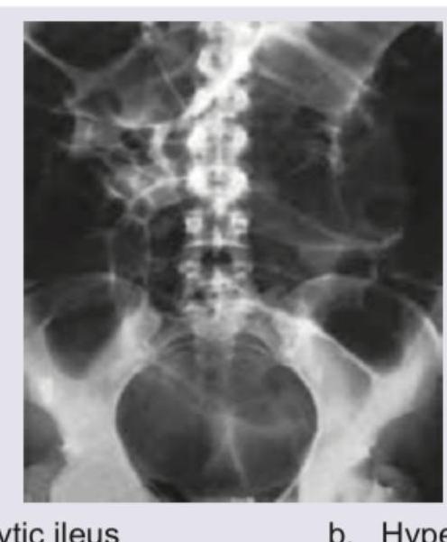 Image for question 537