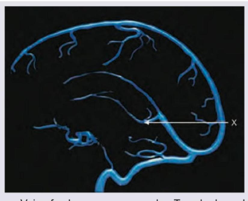 Image for question 364