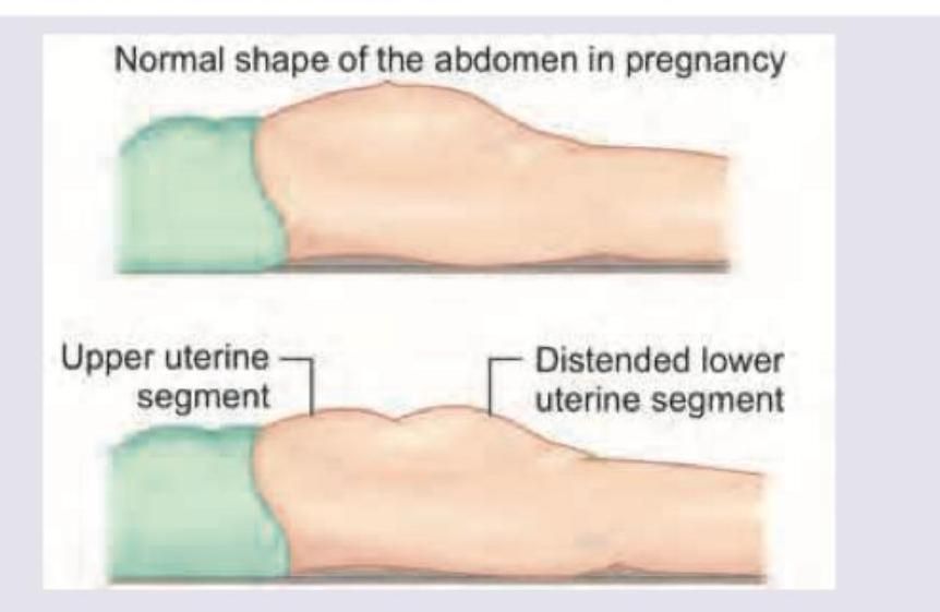 Image for question 850