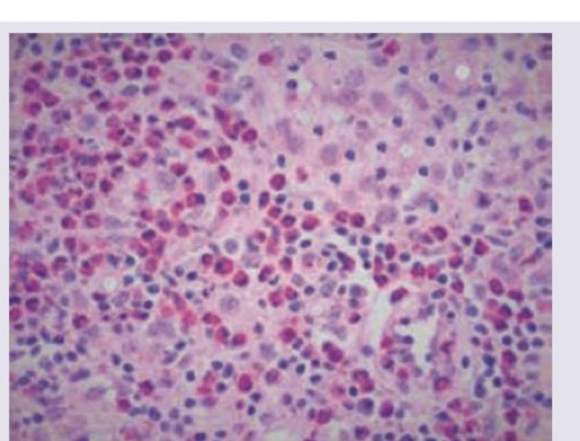 Image for question 368