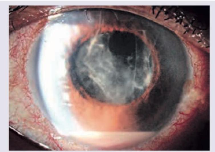 Image for question 89