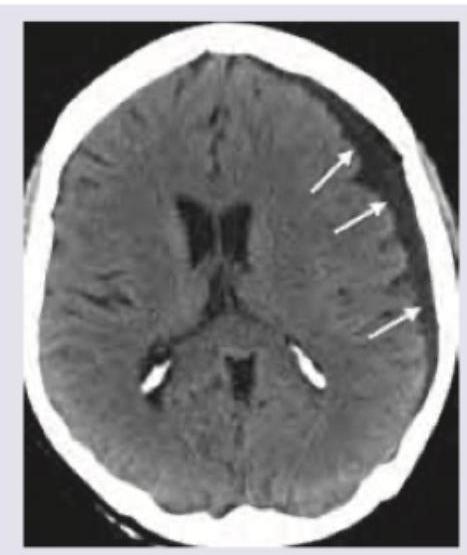 Image for question 18