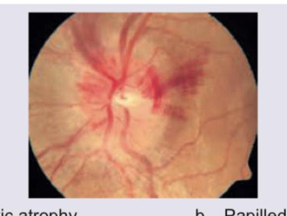 Image for question 450