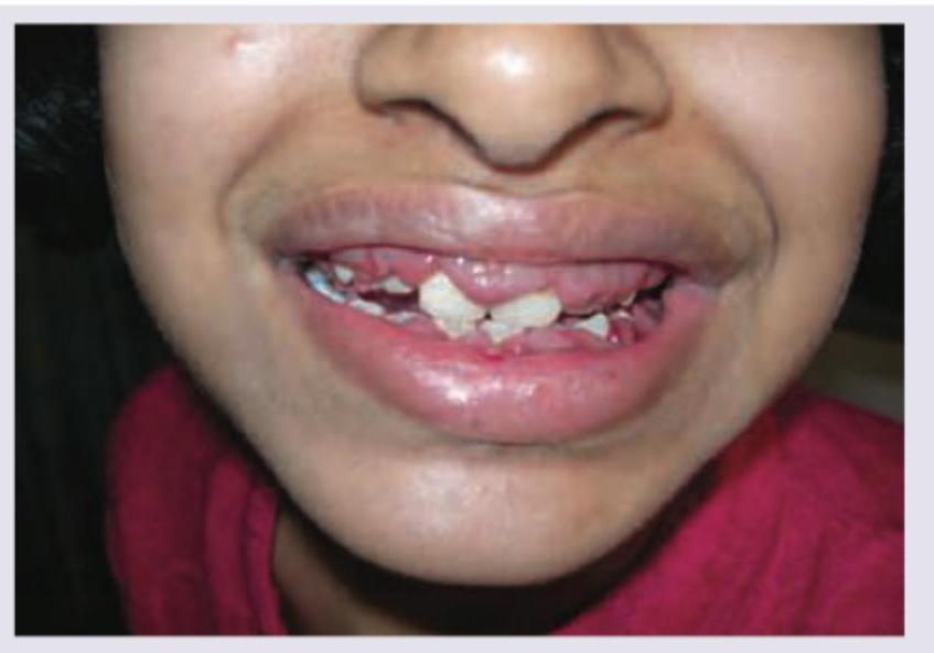 Image for question 649