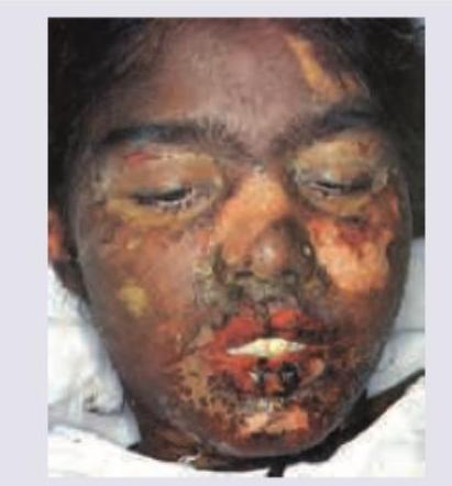 Image for question 150