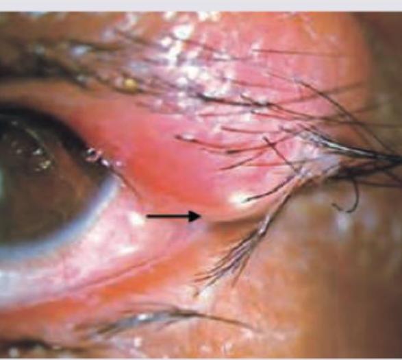 Image for question 39