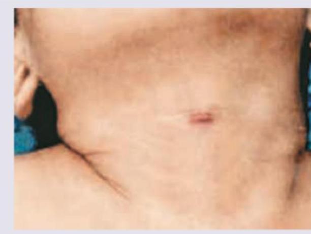 Image for question 309